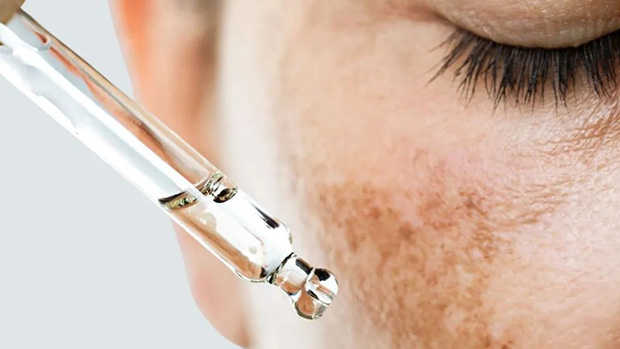 Tăng sắc tố, sạm da, thâm nám là những thay đổi thường gặp ở phụ nữ sau sinh