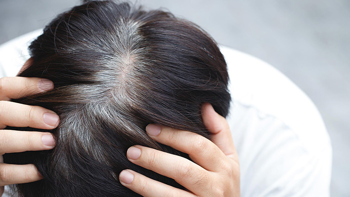 Hiện chưa có bằng chứng khoa học cho thấy vừng đen có thể làm đen tóc bạc