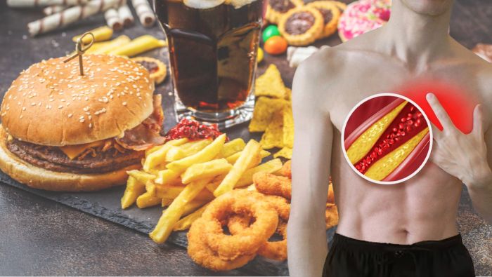 Người gầy hoặc tập luyện thường xuyên vẫn có thể gặp tình trạng cholesterol cao nếu chế độ ăn nhiều chất béo bão hòa