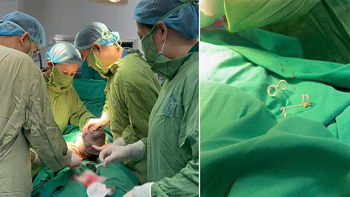Các bác sĩ đón em bé chào đời khỏe mạnh sau khi được can thiệp đặt ống shunt (bên phải) từ trong bụng mẹ - Nguồn: Bệnh viện Phụ sản Trung ương