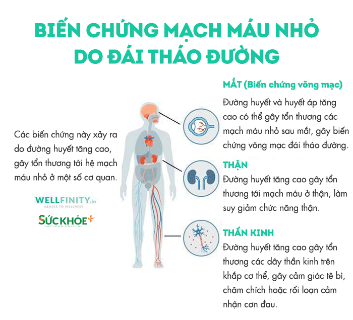 HTD-Bien chung mmau nho