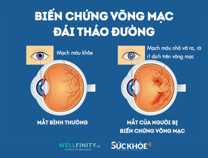 HTD-Bien chung vong mac