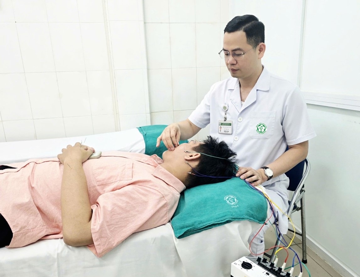 ThS. BS Hoàng Duy Luân, Khoa Y học cổ truyền - Bệnh viện Bạch Mai điện châm cho người bệnh liệt mặt - Ảnh: BVCC