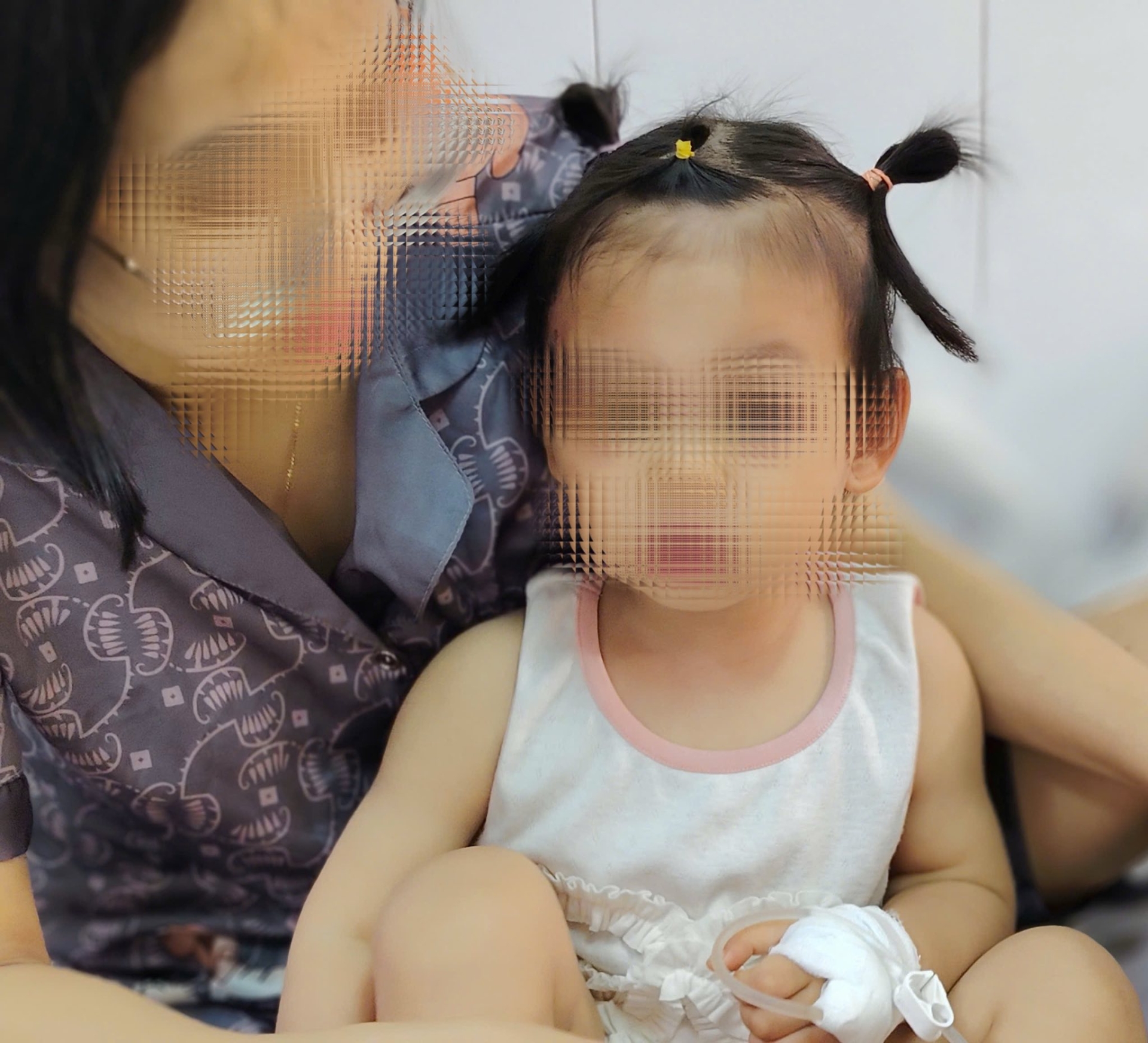 Bé được xử lý vết thương vùng mặt sau tai nạn chó cắn - Ảnh: BVCC.