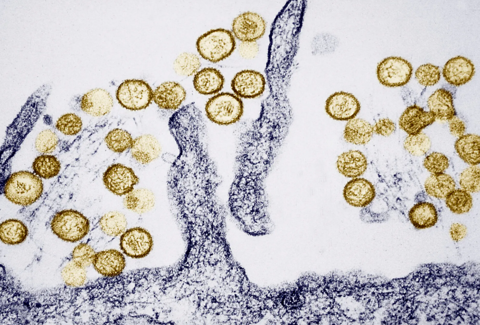 Virus Hanta thường lây lan qua phân khô của động vật gặm nhấm. Ảnh: Getty Images
