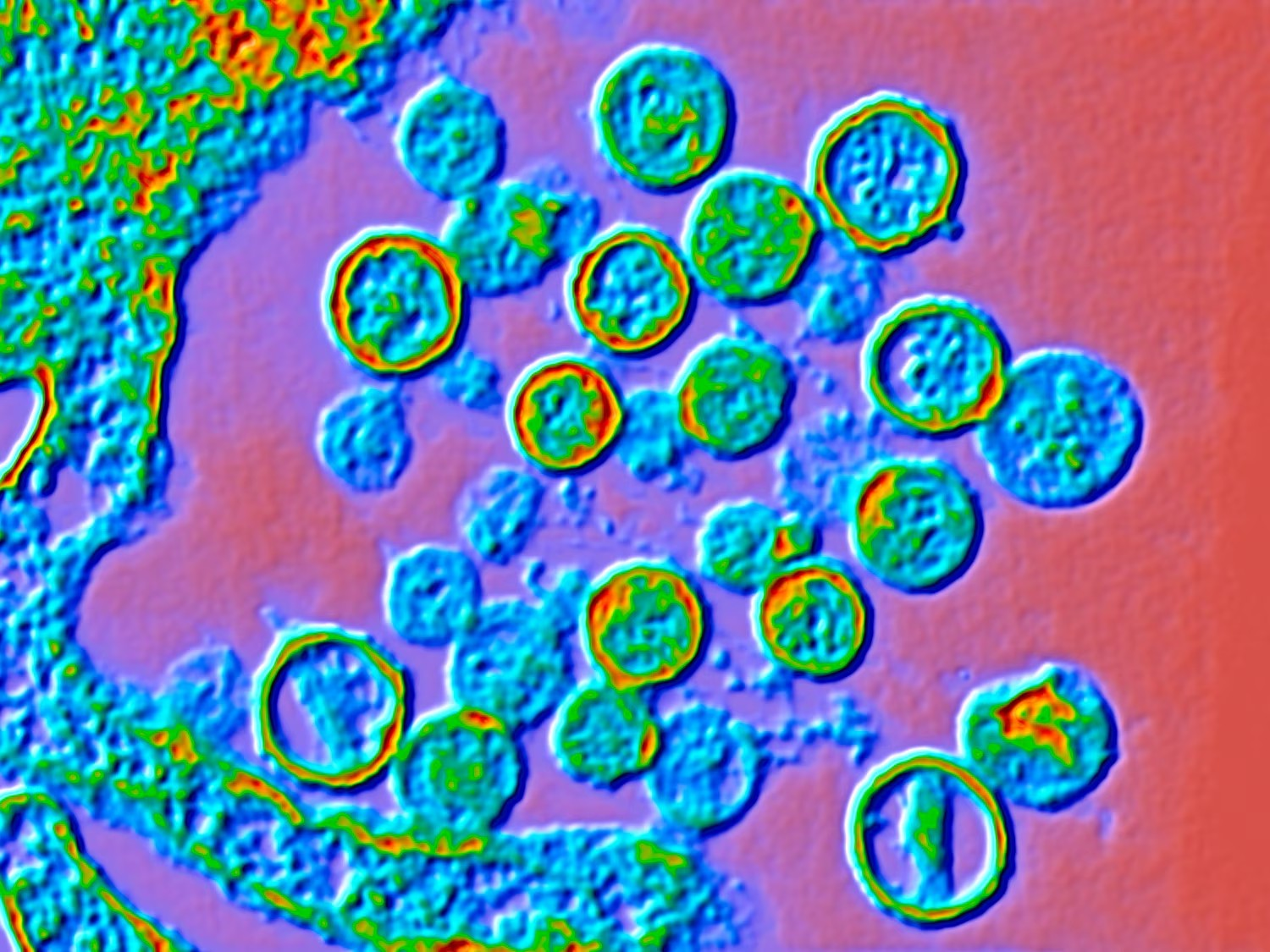 Hình ảnh virus Hanta được phóng đại bằng kính hiển vi điện tử đã được tô màu - Ảnh: Alfred Pasieka/Science Photo Lib/Getty Images