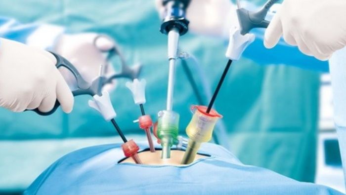 Mổ nội soi u nang buồng trứng có ưu điểm xâm lấn tối thiểu và tính thẩm mỹ cao