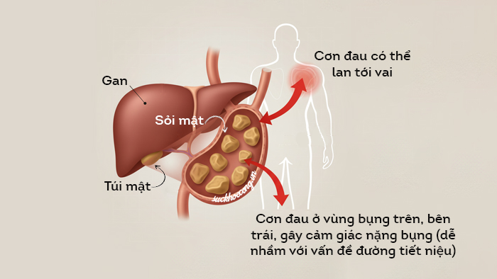soi-mat