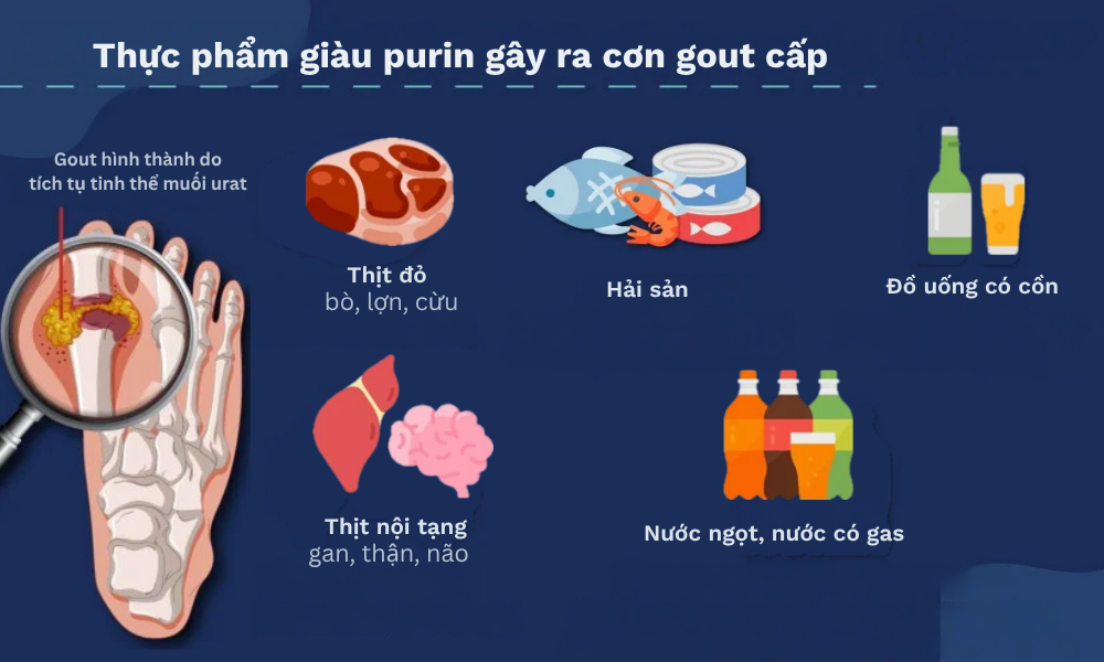 Chế độ ăn giàu purin (thịt đỏ, hải sản, bia rượu) là tác nhân hàng đầu khiến nồng độ acid uric máu tăng cao