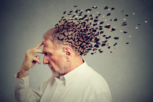 Alzheimer là bệnh lý gây suy giảm trí nhớ, thay đổi hành vi và mất nhận thức trong sinh hoạt đời sống hàng ngày  