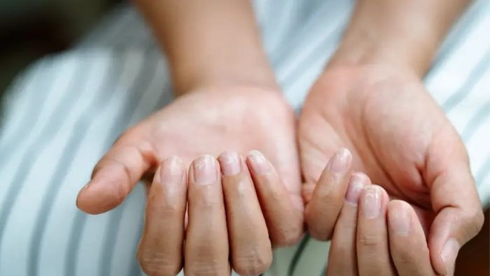 Tê bì, châm chích ở đầu ngón tay, móng tay giòn là dấu hiệu cảnh báo thiếu calci