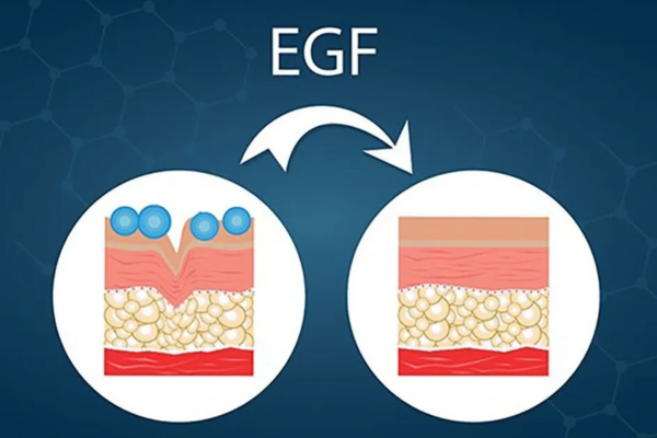 EGF có chức năng giúp phục hồi, tái tạo cấu trúc da và ngăn ngừa sự xuất hiện của nếp nhăn, rãnh nhăn
