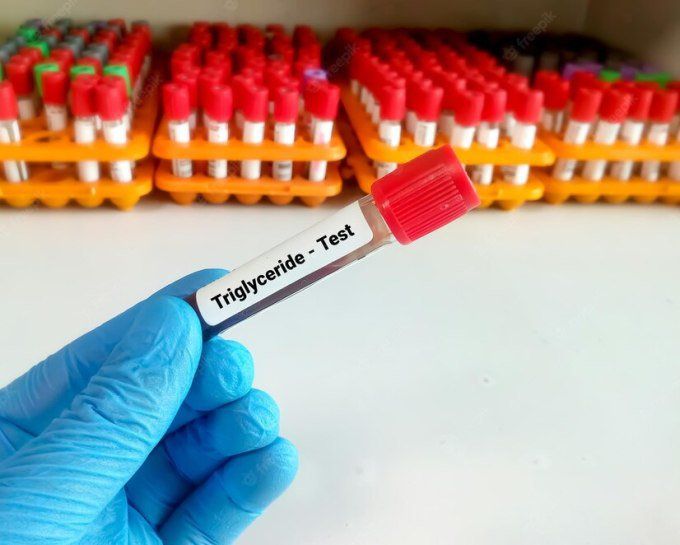 Triglyceride là một dạng chất béo có ở trong máu