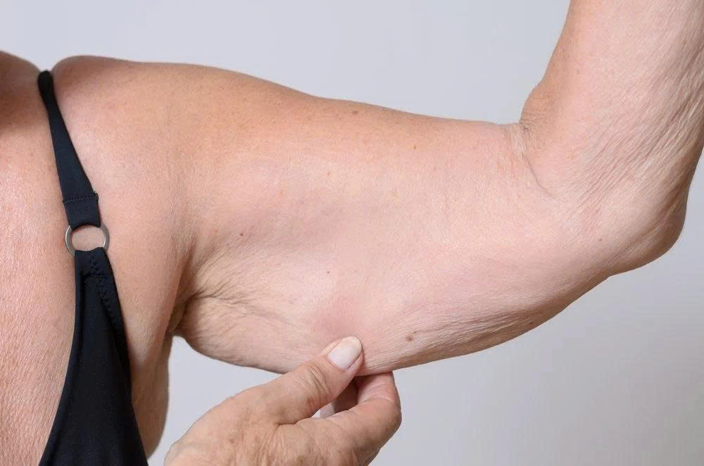 Mất khối cơ có thể ảnh hưởng đến sức mạnh và khả năng vận động