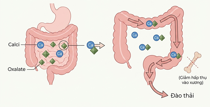 Các chất kháng dinh dưỡng như phytate và oxalate trong thực vật cản trở quá trình hấp thu calci