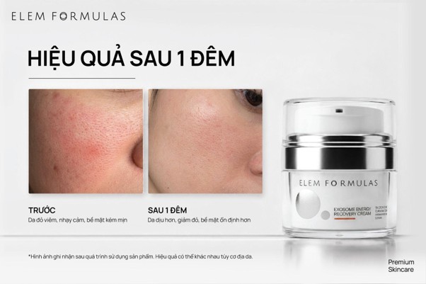 Thực tế ghi nhận trên một người dùng có nền da nhạy cảm bị kích ứng nhẹ do thời tiết cho thấy: sau một đêm sử dụng, vùng đỏ ở má giảm, bề mặt da trông dịu và ổn định hơn. Hiệu quả thực tế có thể khác nhau tùy tình trạng và cơ địa da.