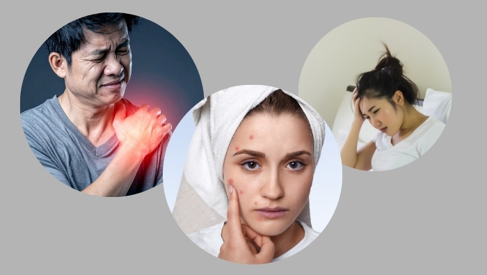 Viêm mạn tính là nguyên nhân cốt lõi dẫn đến nhiều vấn đề sức khỏe