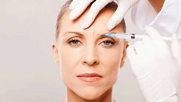 Tiêm Botox là liệu pháp hiệu quả nhất giúp xóa các nếp nhăn 