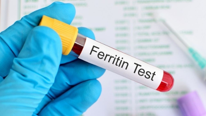 Xét nghiệm ferritin dùng để đo lượng dự trữ sắt trong cơ thể, giúp bác sĩ đánh giá tình trạng thiếu hoặc thừa sắt