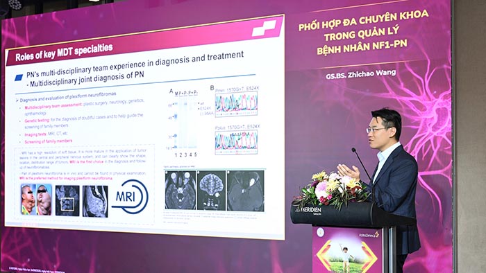 GS.BS. Zhichao Wang phát biểu tại hội thảo
