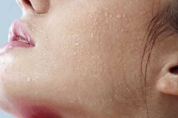 Không chỉ do thời tiết mà ở trong phòng điều hoà quá lâu cũng có thể gây khô da