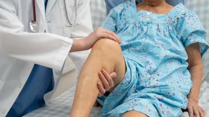 Sau thay khớp gối, người bệnh khó tránh khỏi cảm giác đau