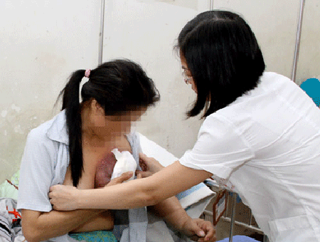 Nguy hiểm khi “tự xử” khối u