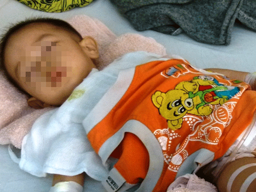 Bác sĩ Mỹ sẽ mổ cho bé bị cắt nhầm bàng quang