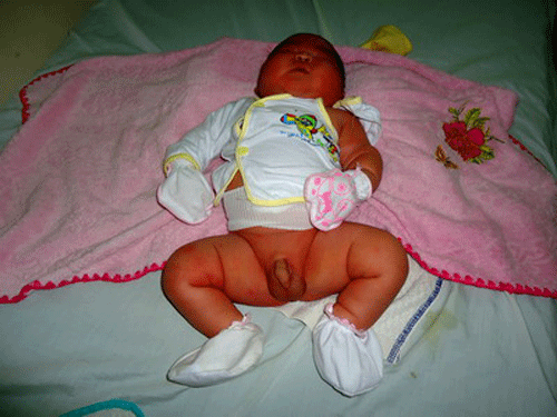 Bình Định: Bé sơ sinh nặng gần 6 kg