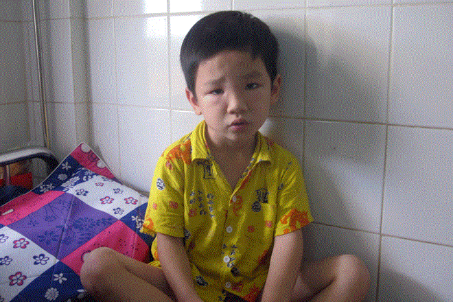 Bé trai nhập viện cấp cứu vì ong vò vẽ đốt