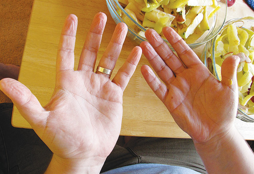 5 tác hại khi dùng dung dịch rửa tay khô - Ảnh 2