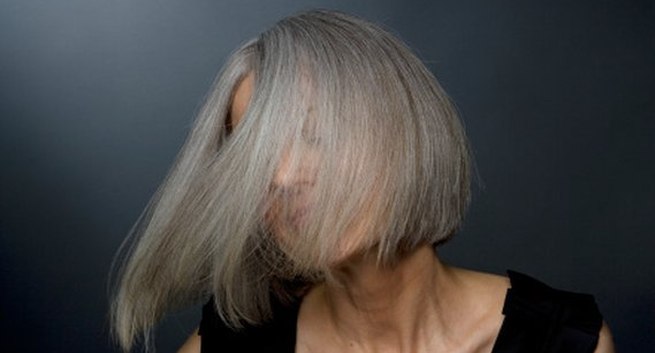 Tóc bạc: Ngoài yếu tố di truyền, căng thẳng, stress cũng là nguyên nhân gây cản trở quá trình nang tóc truyền melanin (sắc tố chịu trách nhiệm về màu tóc), khiến tóc bạc sớm hơn.