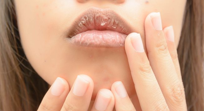 6 thói quen hàng ngày đang làm khô đôi môi của bạn - Ảnh 7