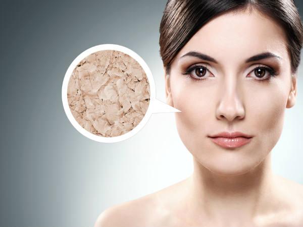 Bệnh xơ cứng bì: Tình trạng này được đặc trưng bởi sự phát triển bất thường của collagen khiến làn da trở nên dày lên và tối màu. Đây là một trong những bệnh tự miễn dịch hàng đầu ảnh hưởng đến phụ nữ.