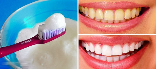 Làm trắng răng bằng 9 cách tự nhiên an toàn ngay tại nhà - Ảnh 10