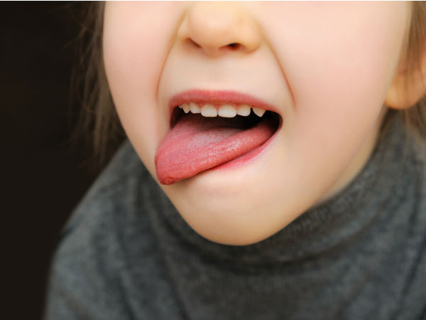 Màu hồng nhạt: Lưỡi có màu hồng nhạt được coi là dấu hiệu chứng tỏ cơ thể của bạn hoàn toàn khỏe mạnh. Nếu lưỡi của mình có màu hông nhạt thì bạn có thể yên tâm về tình trạng sức khỏe của bản thân.