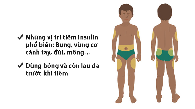 Infographic: Người bệnh đái tháo đường đã biết tiêm insulin đúng cách? - Ảnh 7