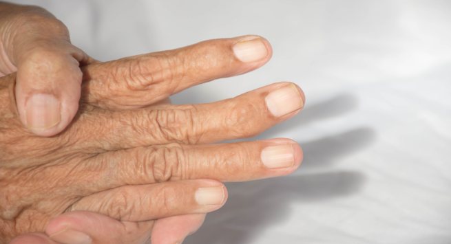 5 bài tập đơn giản để giảm đau khớp ngón tay - Ảnh 4