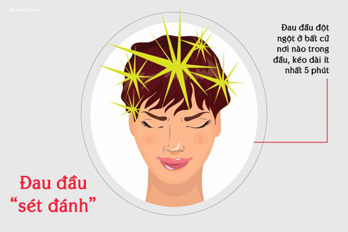 Những kiểu đau đầu thường gặp và cách nhận diện chúng - Ảnh 5