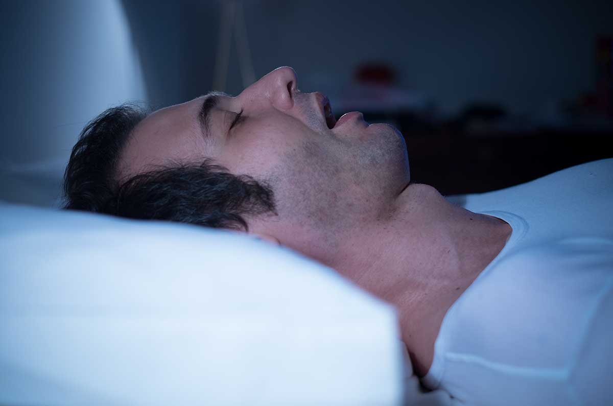 Chứng ngưng thở khi ngủ: Chất béo dư thừa tích tụ ở các cơ quan nội tạng, đặc biệt là ở ngực có thể chèn ép phổi khiến hơi thở của bạn bị hạn chế. Đó là một nguyên nhân gây ra chứng ngưng thở khi ngủ.