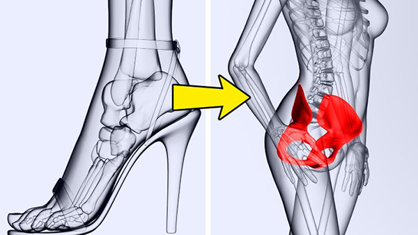 Tác động xấu đến hông: Một nghiên cứu cho thấy, nếu bắt đầu đi giày cao gót từ quá sớm, bạn có thể sẽ bị đau hông sau này. 