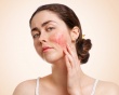 Lupus ban đỏ và ảnh hưởng đến sức khỏe toàn diện