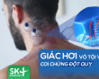 Podcast: Giác hơi vô tội vạ, coi chừng đột quỵ