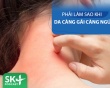 Podcast: Da bị ngứa càng gãi càng ngứa - Làm thế nào?