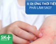 Podcast: Bị dị ứng thời tiết phải làm sao? 