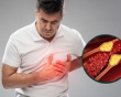 Lầm tưởng thường gặp về cholesterol
