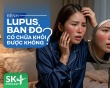 Podcast: Bệnh lupus ban đỏ có chữa khỏi được không?