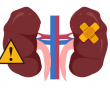 Suy thận độ 1 biểu hiện như thế nào?