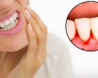 Chảy máu chân răng cảnh báo bệnh gì?