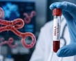 Biết gì về virus Bundibugyo có liên quan đến dịch Ebola?